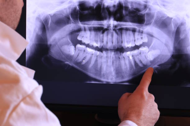 Best Emergency TMJ Treatment in Steubenville, OH