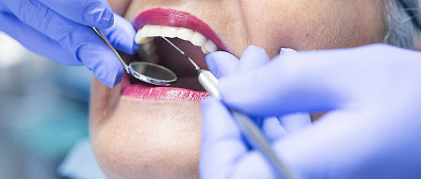 Best Emergency Treatment for Dental Infections or Abscesses in Steubenville, OH